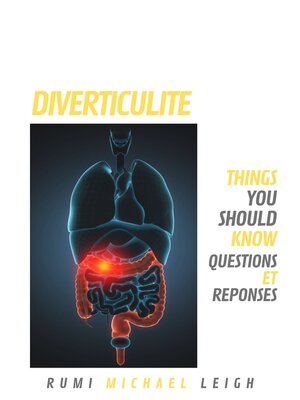 cover image of Diverticulite